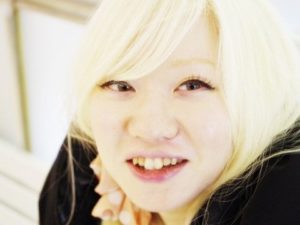 アルビノ,日本人,モデル