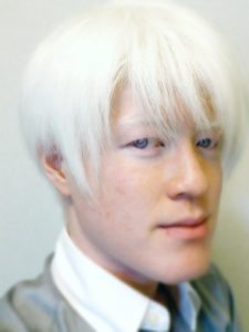 アルビノ,日本人,目の色