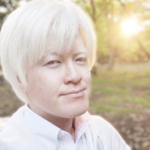 アルビノ,日本人,モデル